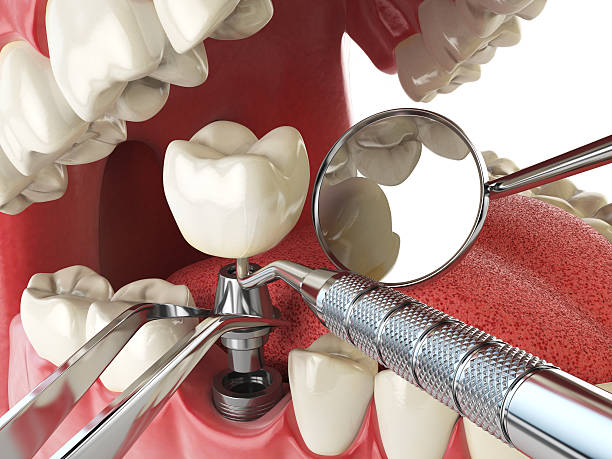 Best Emergency Dental Care for Broken or Chipped Teeth in Decatur, AR