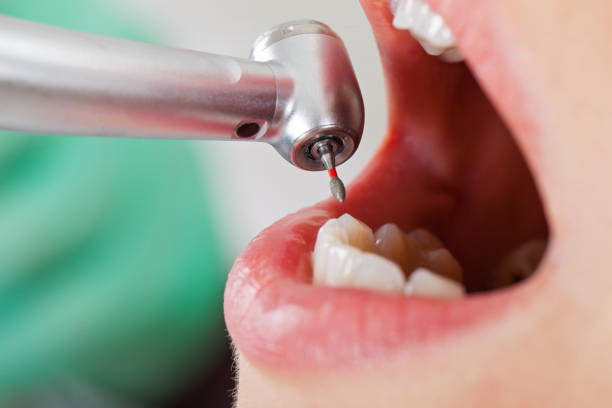 Best Emergency Treatment for Dental Infections or Abscesses in Decatur, AR